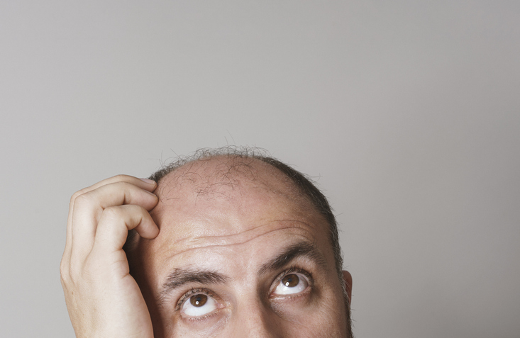 Mid adult bald man looking up, studio shot